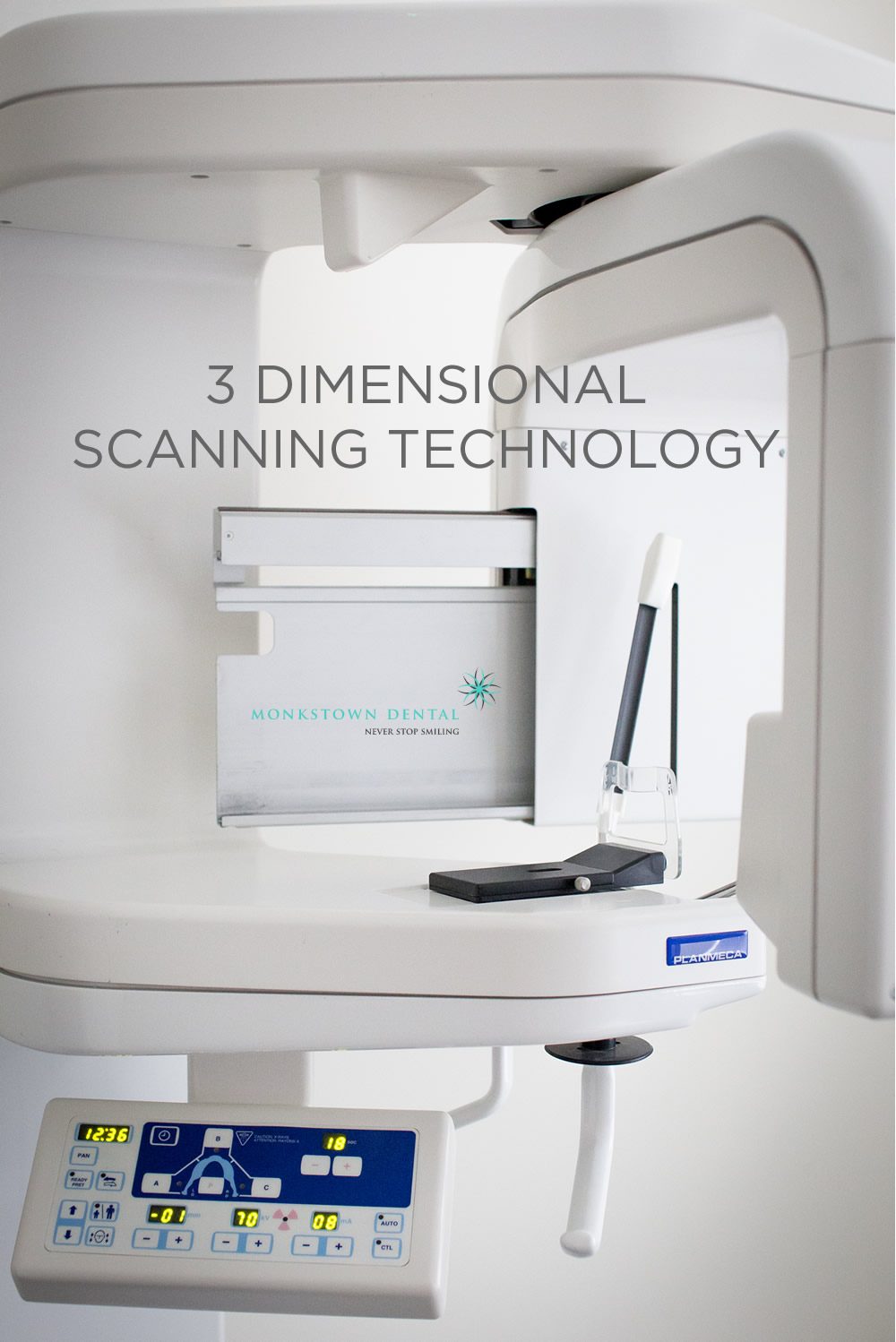 monkstown 3d scanning machine