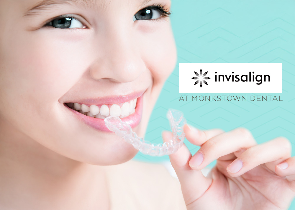 clear braces at Monkstown